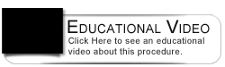 Dental Education Video - Advanced Periodontitis